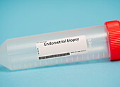 Endometrial biopsy