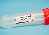 Gonorrhoea and chlamydia tests