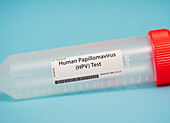 Human papillomavirus test