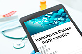 Intrauterine device insertion