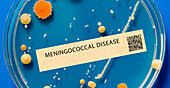 Meningococcal disease