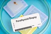 Parathyroid biopsy