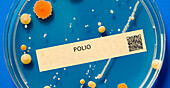Polio viral infection