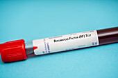 Rheumatoid factor (rf) test