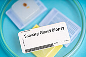 Salivary gland biopsy