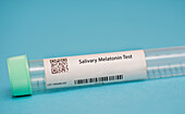 Salivary melatonin test