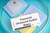 Transrectal ultrasound-guided biopsy