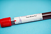 Tumour marker test