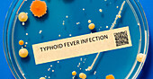 Typhoid bacterial infection