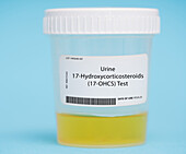 Urine 17-hydroxycorticosteroids test