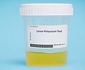 Urine potassium test