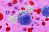 T cells attacking acute myeloid leukaemia cell, illustration