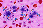 Monoclonal antibody treatment of multiple myeloma cell, illustration