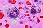 T cells attacking non-Hodgkin's lymphoma cells, illustration