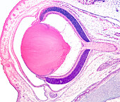 Developing rat eye, light micrograph