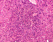 Foetal hepatic haematopoiesis, light micrograph
