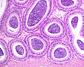 Epididymis, light micrograph