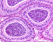 Epididymis pseudostratified epithelium, light micrograph