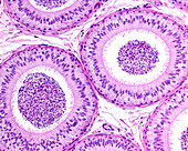 Epididymis pseudostratified epithelium, light micrograph