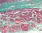 Human oesophagus muscular layer, light micrograph