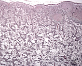 Lymph node reticular fibres, light micrograph