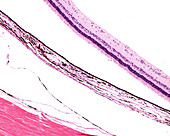 Eyeball layers, light micrograph