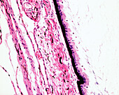 Ciliary body epithelium, light micrograph