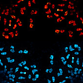 Macrophage poke ball, conceptual confocal micrograph