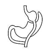 Gastric bypass surgery, illustration