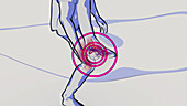 Foot pain, conceptual illustration