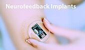 Neurofeedback implantable device, conceptual image