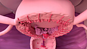 Uterus during menstruation, illustration