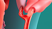 Ejaculatory fluid being added to sperm, illustration