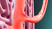 Ejaculate moving into the prostate, illustration
