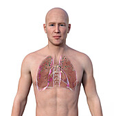Man with silicosis nodules in the lungs, illustration