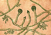 Lichtheimia corymbifera fungi, illustration