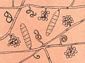 Trichophyton mentagrophytes fungi, illustration