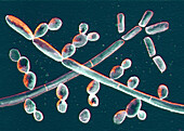 Trichosporon fungi, illustration