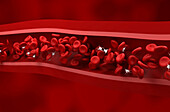 Thrombocytopaenia, illustration