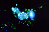 Cryptococcus neoformans fungus from nasal sample, light micrograph