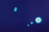 Cryptococcus neoformans fungus, light micrograph