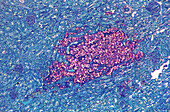 Feline kidney tissue infected by Cryptococcus neoformans fungus, light micrograph