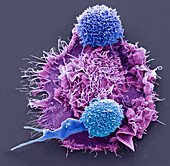 Macrophage and T cells, SEM