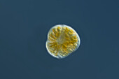 Alexandrium tamutum algae, light micrograph