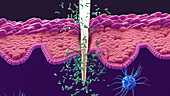 Bacteria entering the body via a needle wound, illustration