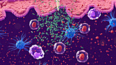 White blood cells responding to bacterial infection, illustration