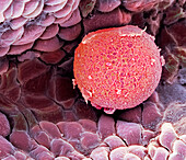 Human ovum in fallopian tube, SEM