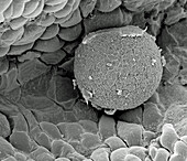 Human ovum in fallopian tube, SEM