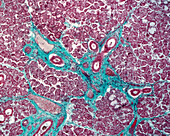 Submandibular gland, light micrograph