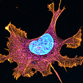 Migrating Ewing sarcoma cancer cell, confocal light micrograph